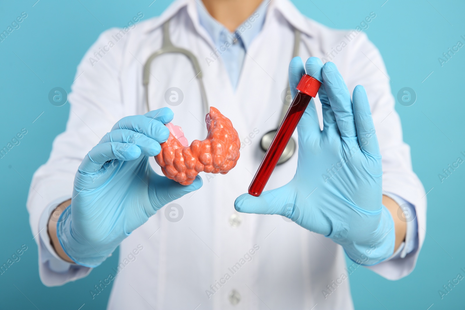 Photo of Endocrinologist showing thyroid gland model and blood sample on light blue background, closeup