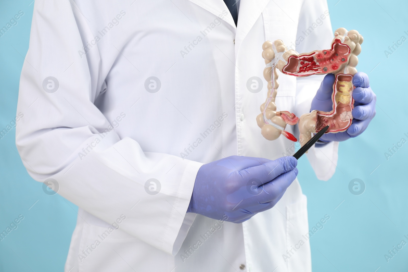 Photo of Doctor showing model of large intestine on light blue background, closeup