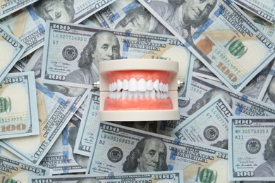Photo of Educational dental typodont model on heap of dollar banknotes, top view. Expensive treatment