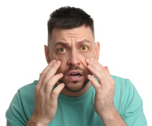 Scared man checking his health condition on white background. Yellow eyes as symptom of problems with liver