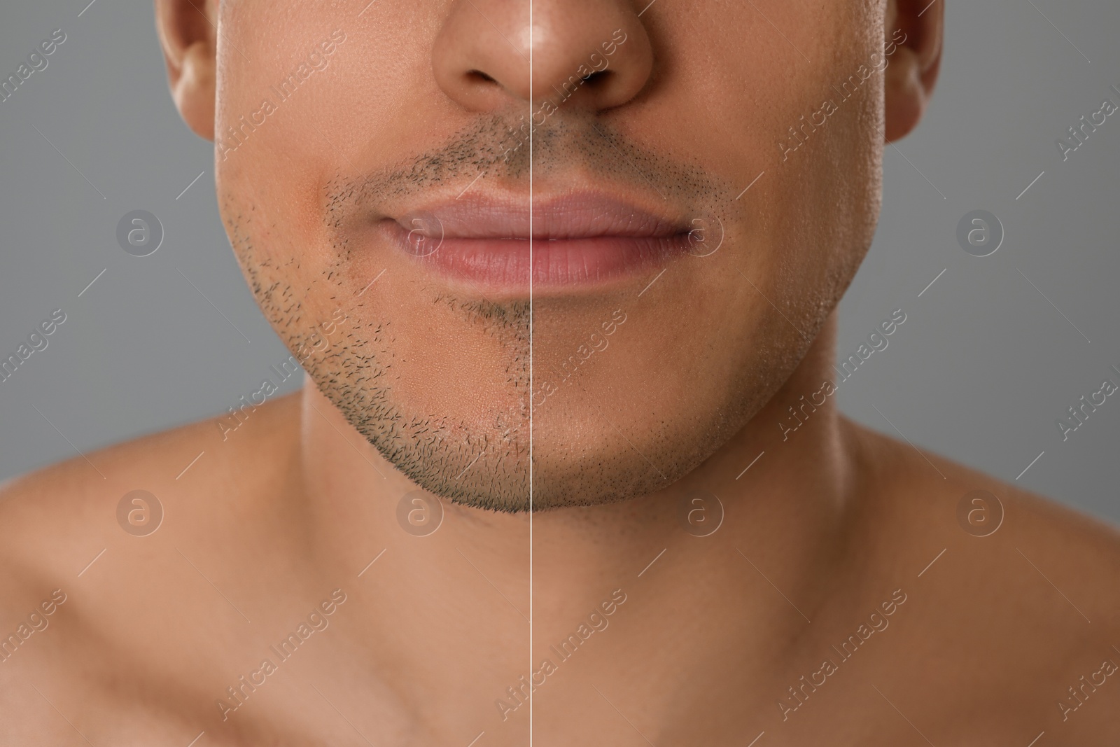 Image of Collage with photos of handsome man before and after shaving on grey background, closeup 