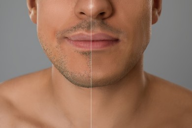 Collage with photos of handsome man before and after shaving on grey background, closeup 