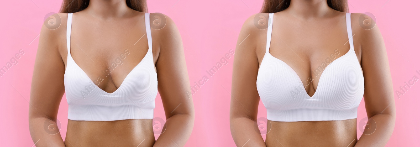 Image of Woman before and after breast augmentation on pink background, closeup. Collage with photos showing difference between breast sizes