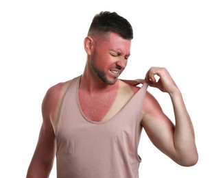 Man with sunburned skin on white background