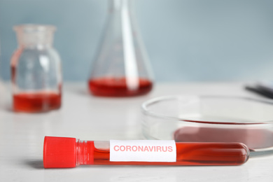 Photo of Test tube with blood sample and label CORONA VIRUS on table in laboratory