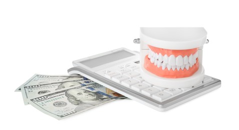 Photo of Educational dental typodont model, calculator and dollar banknotes on white background. Expensive treatment