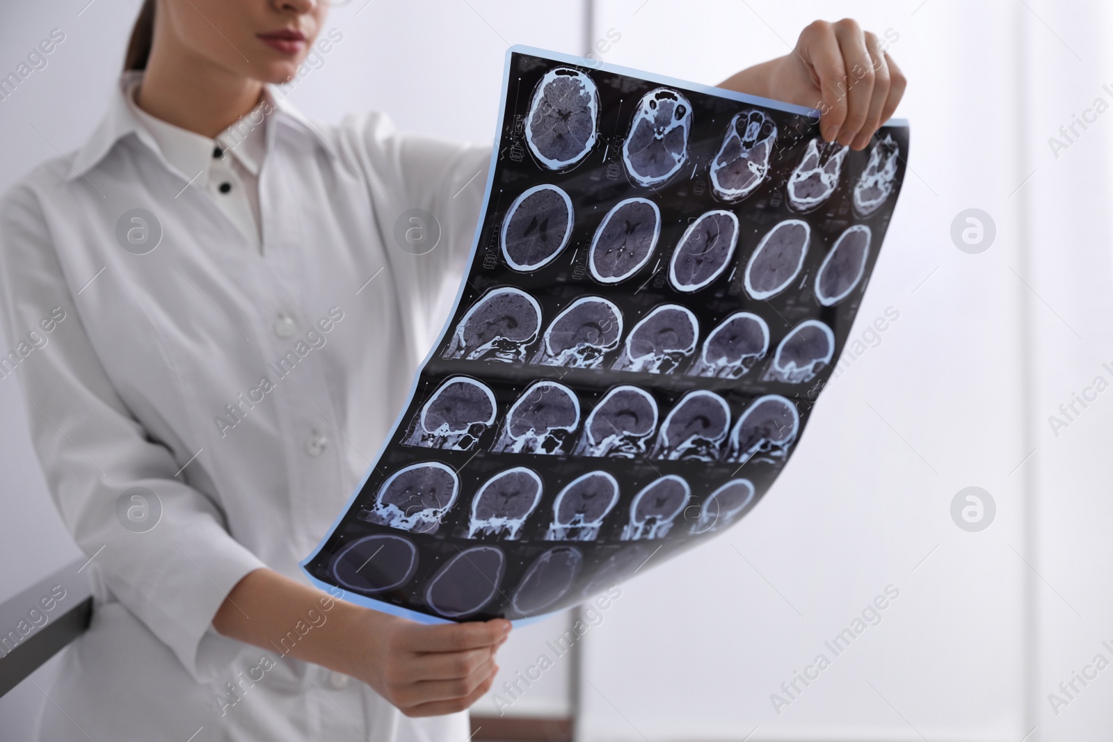 Photo of Doctor examining MRI images of patient with multiple sclerosis in clinic, closeup