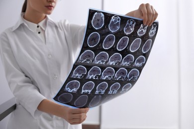 Photo of Doctor examining MRI images of patient with multiple sclerosis in clinic, closeup