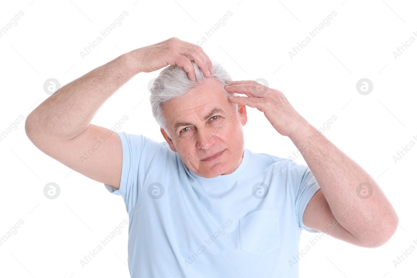 Photo of Senior man with hair loss problem isolated on white