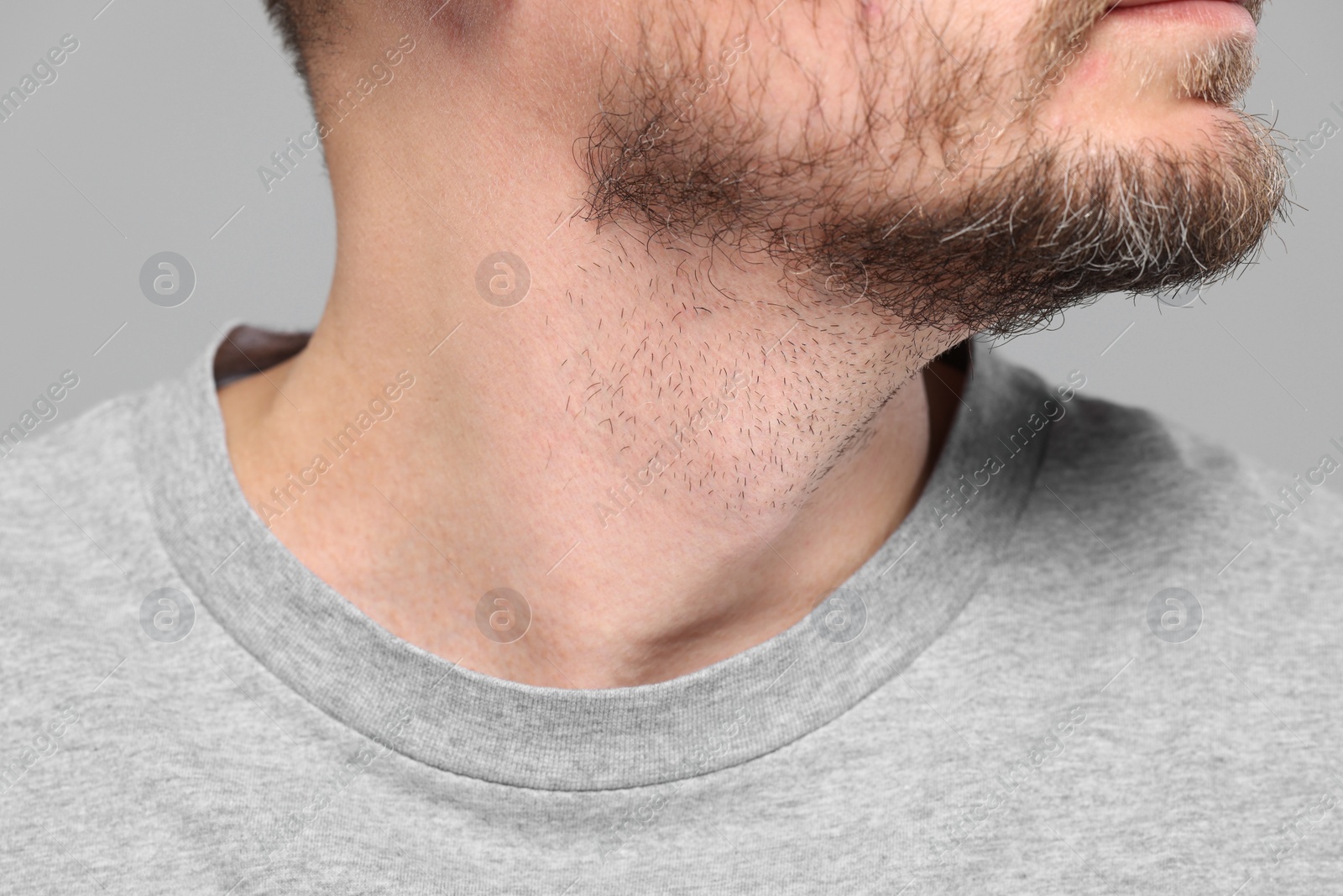 Photo of Closeup view of man with normal skin on grey background