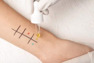 Doctor making allergy test at table, top view