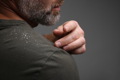 Photo of Bearded man brushing dandruff off his t-shirt on grey background, closeup. Space for text