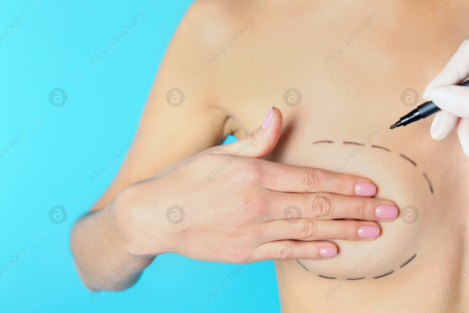 Photo of Doctor drawing marks on patient's breast for cosmetic surgery operation against color background, closeup