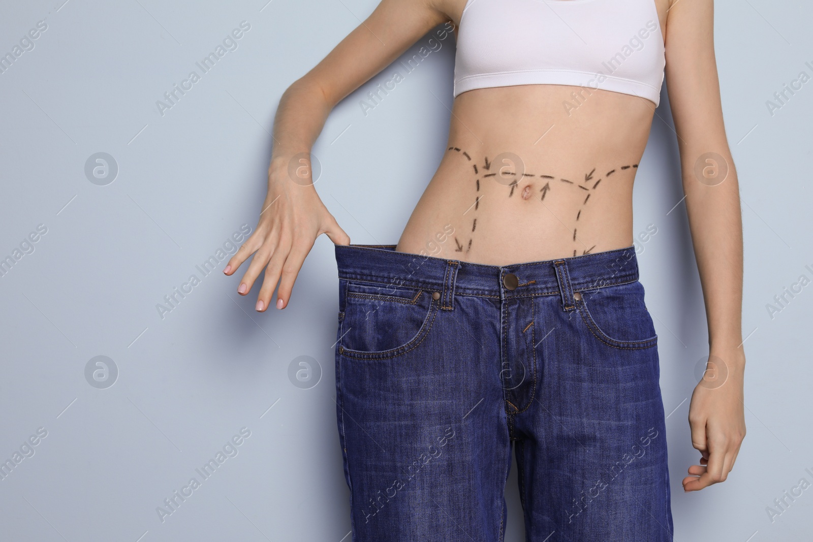 Photo of Young woman with marks on belly in big jeans after cosmetic surgery operation against color background