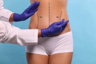 Image of Doctor and patient preparing for cosmetic surgery, light blue background. Woman with markings on her abdomen, closeup