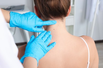 Dermatologist examining patient's birthmark in clinic, closeup