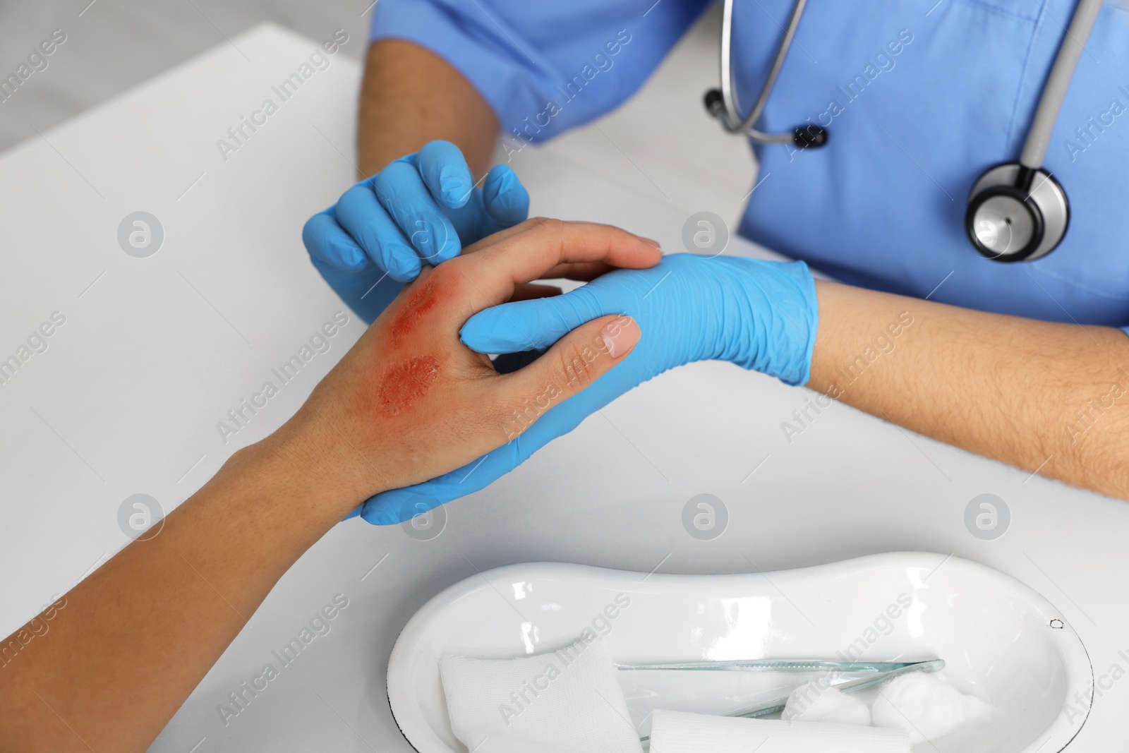 Photo of Doctor examining patient's burned hand at table, closeup