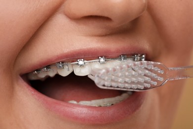 Photo of Smiling woman with dental braces cleaning teeth, closeup
