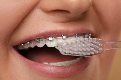 Smiling woman with dental braces cleaning teeth, closeup