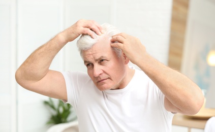 Photo of Senior man with hair loss problem indoors
