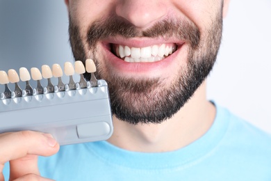 Photo of Young man with teeth color samples on light background, closeup