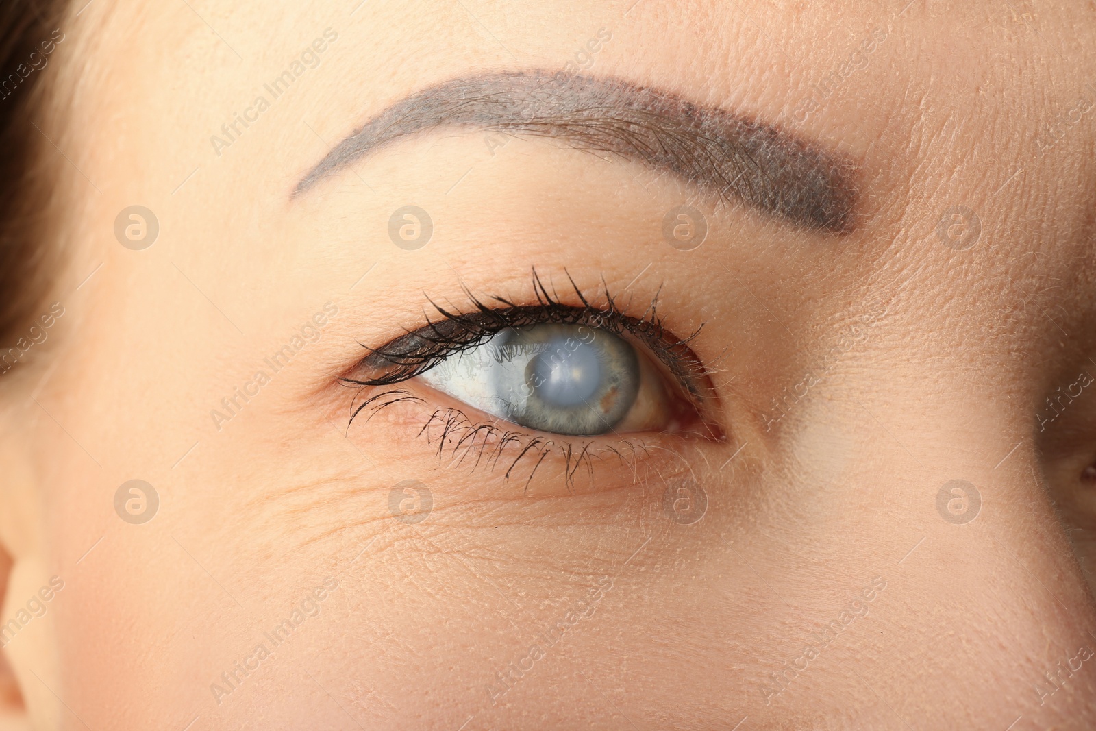 Photo of Closeup view of mature woman suffering from cataract