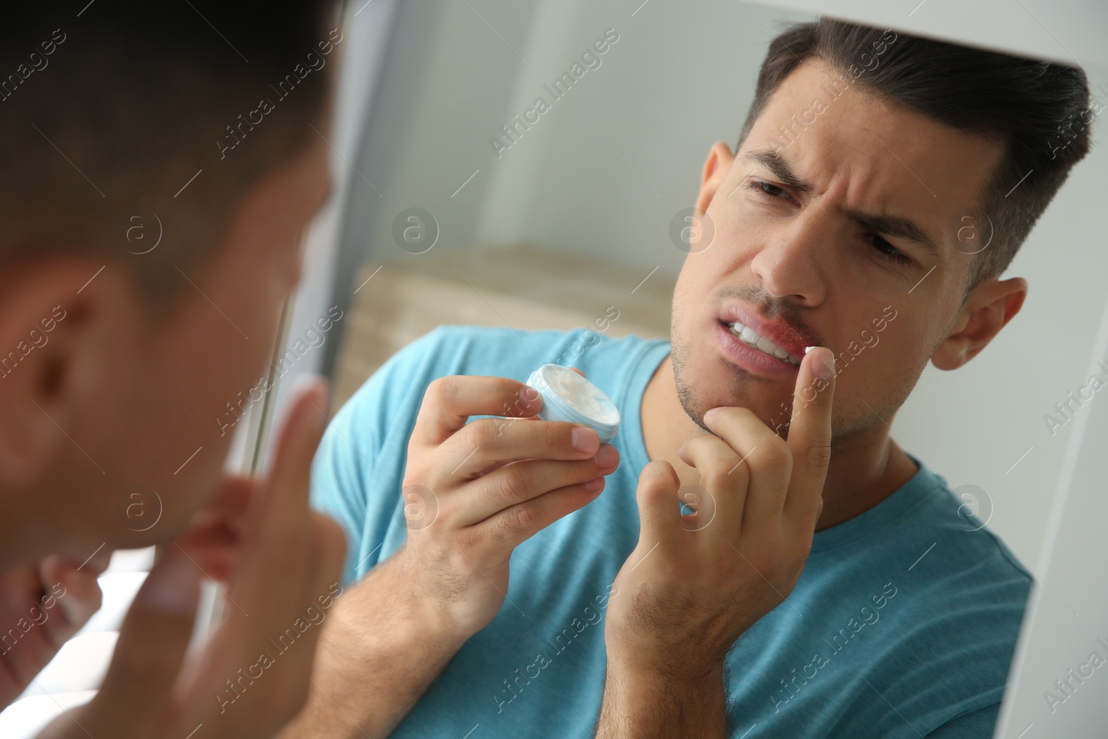 Photo of Man with herpes applying cream on lips in front of mirror at home