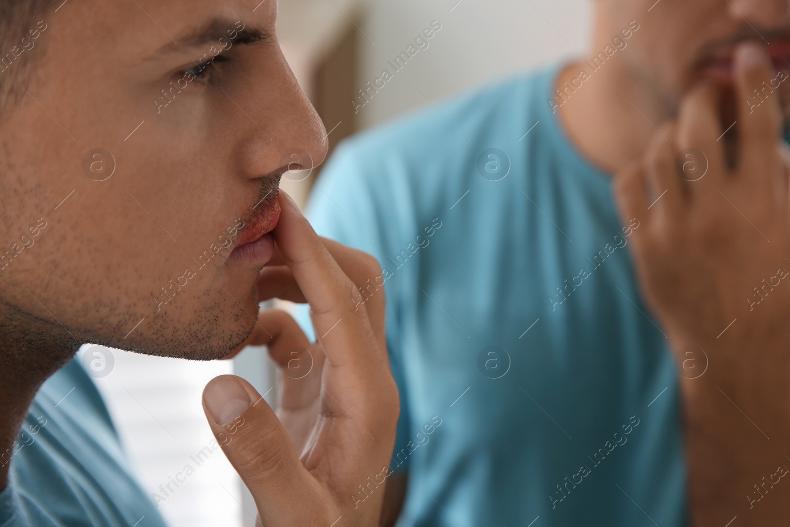 Photo of Man with herpes touching lips in front of mirror, closeup