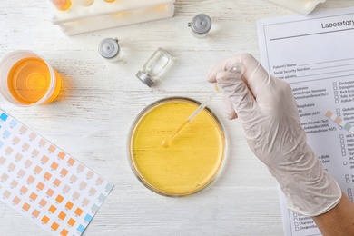 Photo of Laboratory worker taking urine sample from dish at table, top view. Urology concept