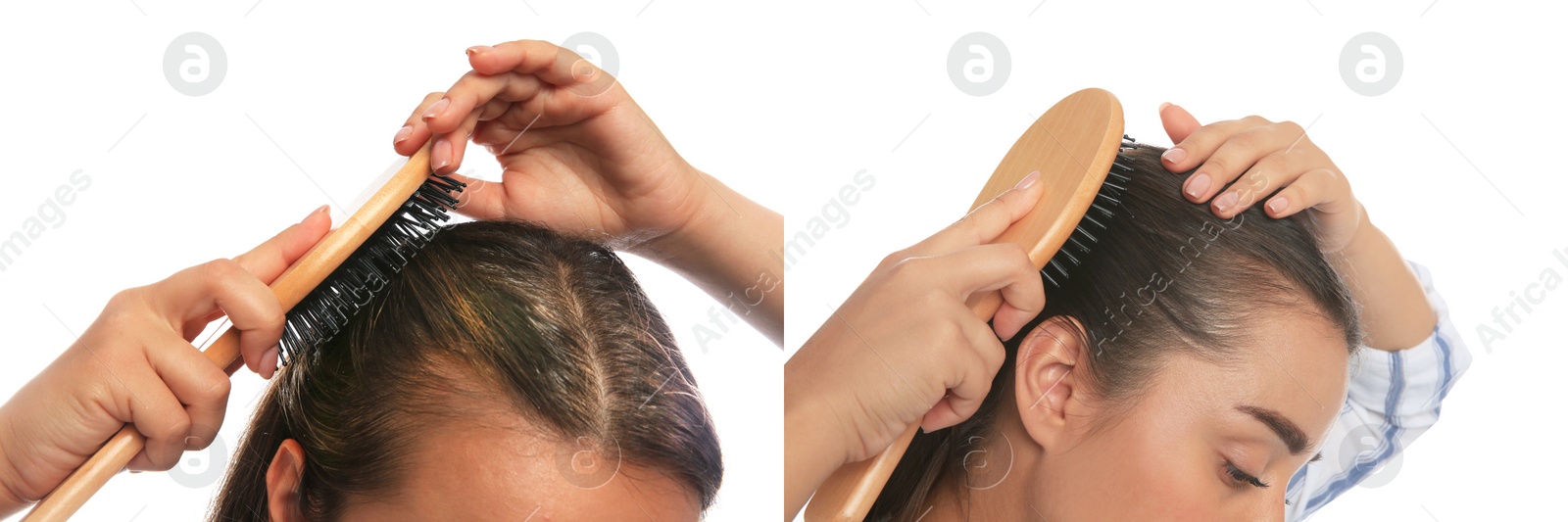 Image of Woman before and after hair treatment with high frequency darsonval device on white background, closeup. Collage of photos