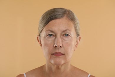 Photo of Woman with normal skin on beige background