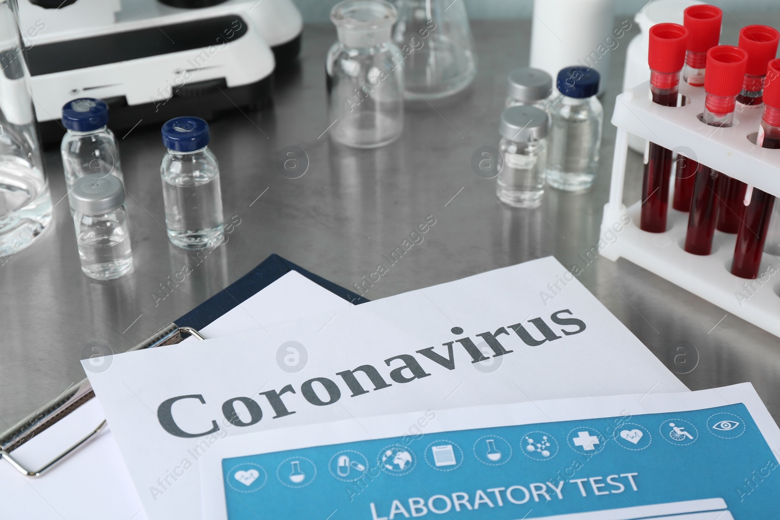 Photo of Clipboard with laboratory test list and word CORONAVIRUS on grey table, closeup