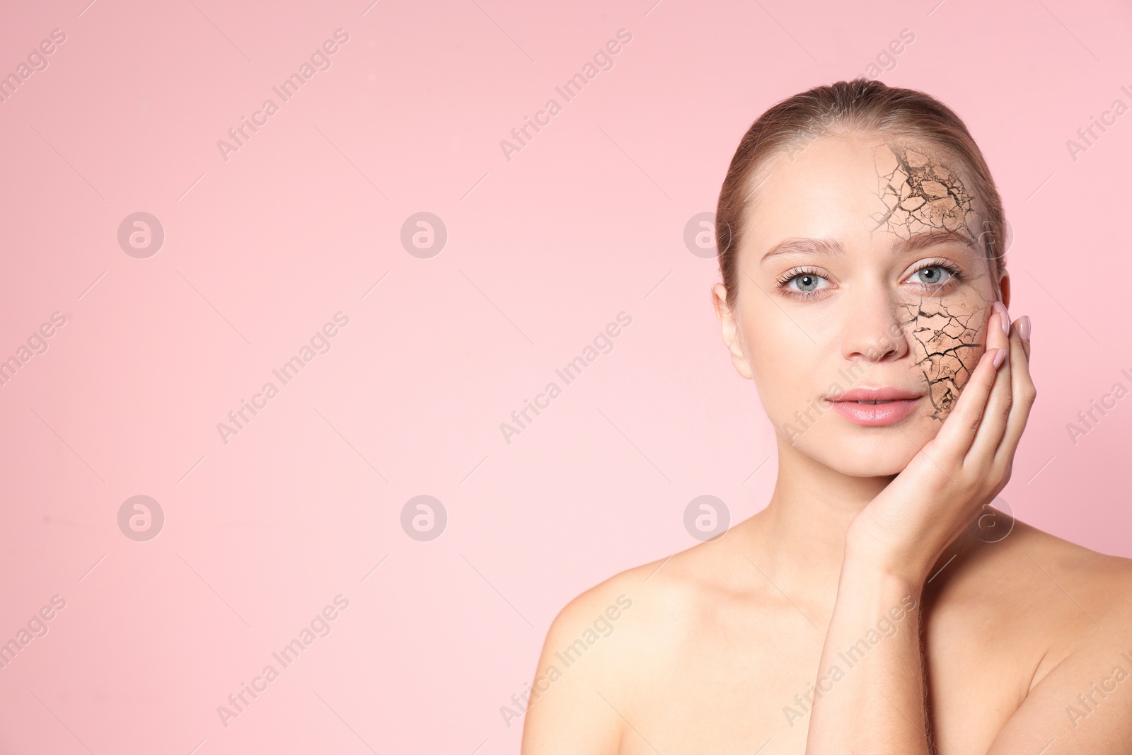 Image of Beautiful young woman with dry skin on pink background. Space for text