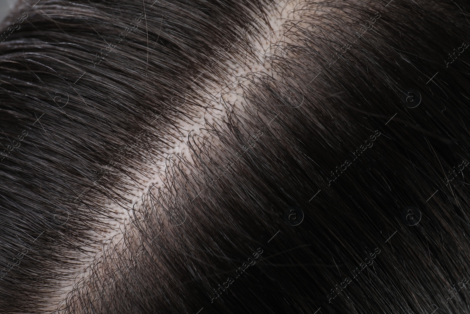 Photo of Closeup view of healthy dark woman`s hair