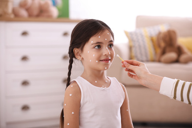 Mother applying cream onto skin of her daughter with chickenpox at home