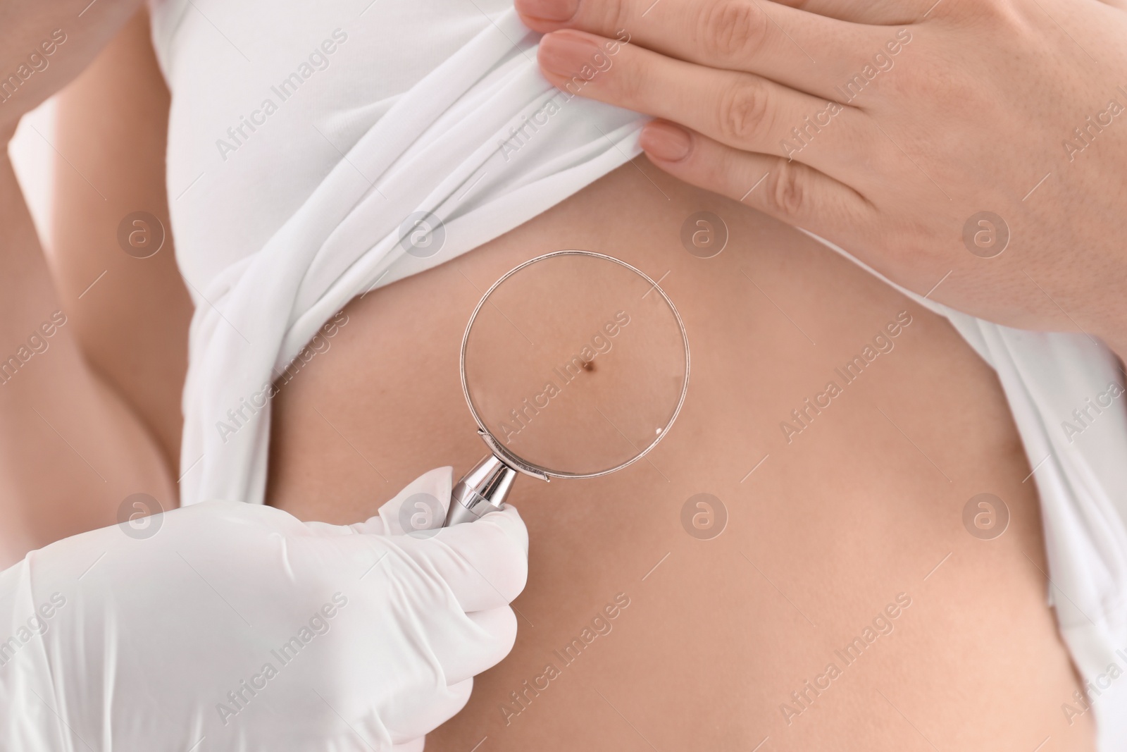 Photo of Dermatologist examining patient with magnifying glass in clinic, closeup view