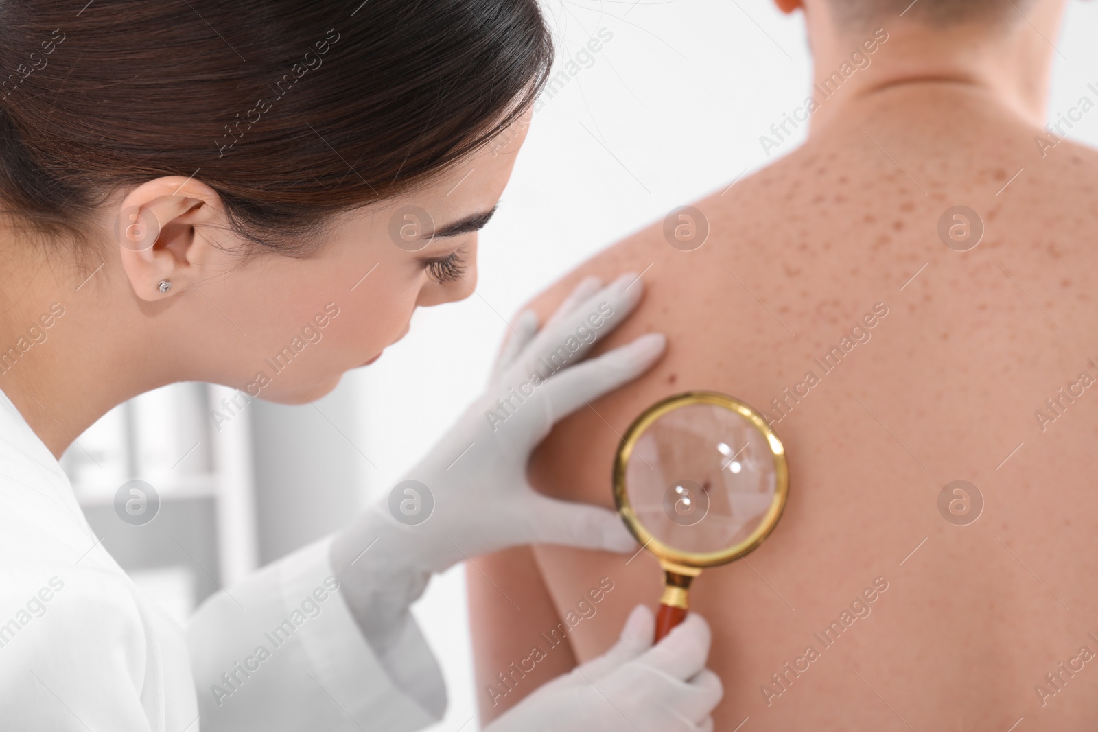 Photo of Dermatologist examining patient with magnifying glass in clinic, closeup view