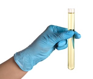 Doctor holding test tube with urine sample for analysis on white background