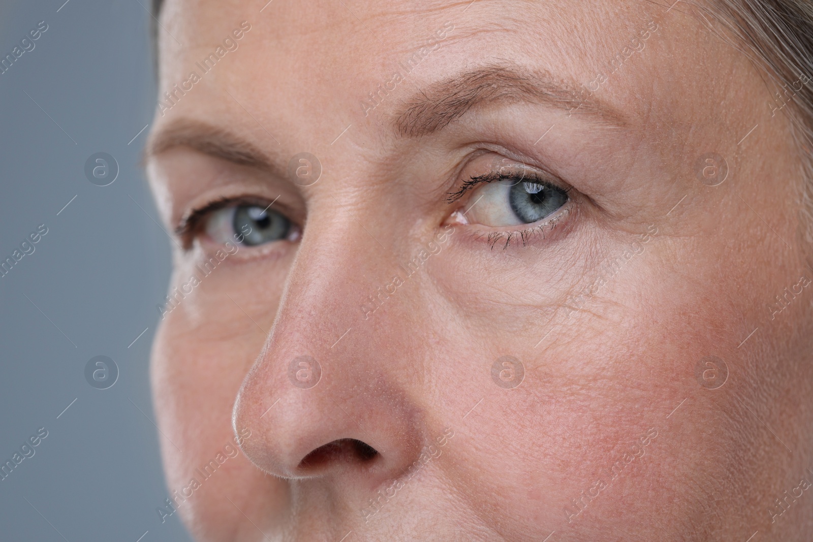 Photo of Senior woman with aging skin on grey background, closeup. Rejuvenation treatment