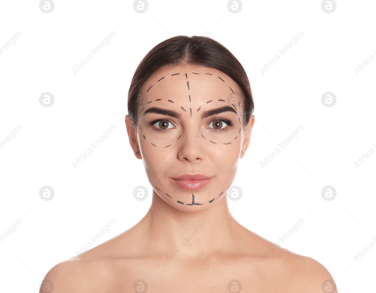 Photo of Young woman with marks on face for cosmetic surgery operation against white background