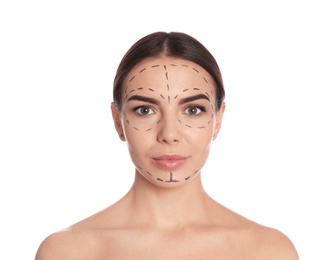 Photo of Young woman with marks on face for cosmetic surgery operation against white background