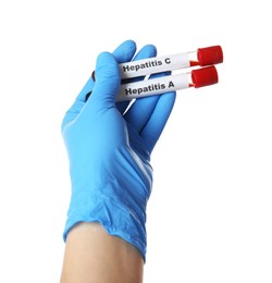 Scientist holding tubes with blood samples for hepatitis virus test on white background, closeup