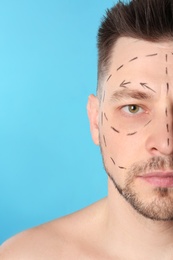 Photo of Man with marks on face for cosmetic surgery operation against blue background, closeup