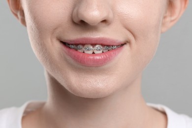 Photo of Smiling woman with dental braces on grey background, closeup