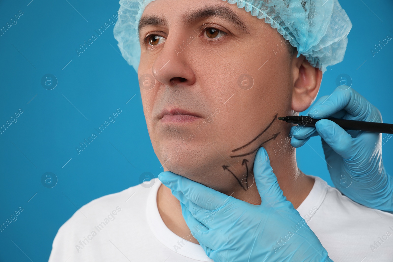 Photo of Surgeon with marker preparing man for operation on blue background. Double chin removal