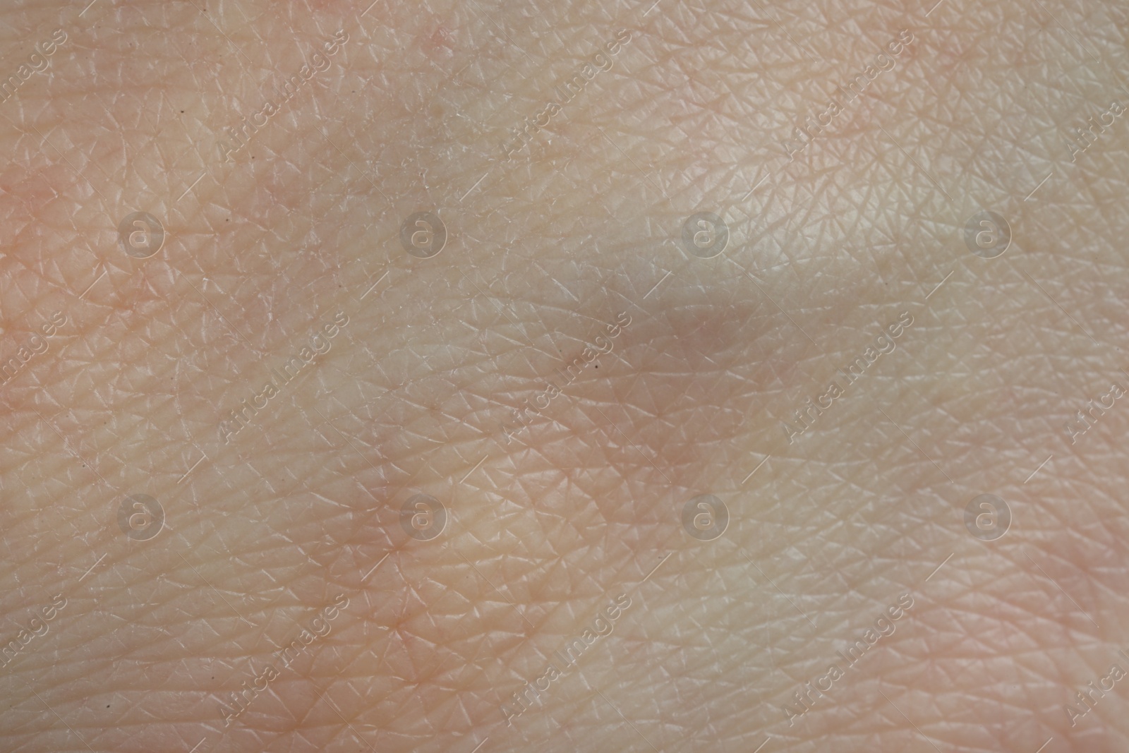 Photo of Texture of healthy skin as background, macro view