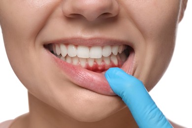 Image of Doctor examining woman's inflamed gum on white background, closeup