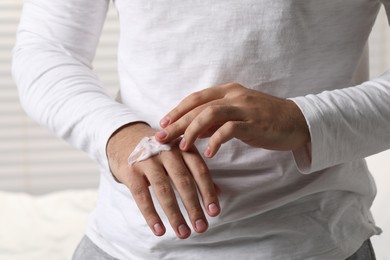 Man with dry skin applying cream onto his hand on light background, closeup