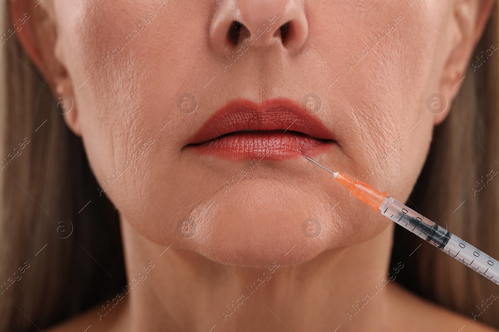 Photo of Senior woman getting lips injection, closeup. Cosmetic surgery