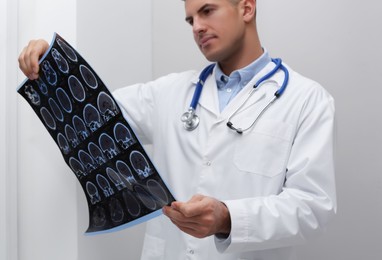 Photo of Doctor examining MRI images of patient with multiple sclerosis in clinic